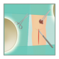 Knees Surgery icon