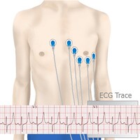 Basic ECG Interpretation icon