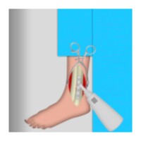 Ankle Surgery icon